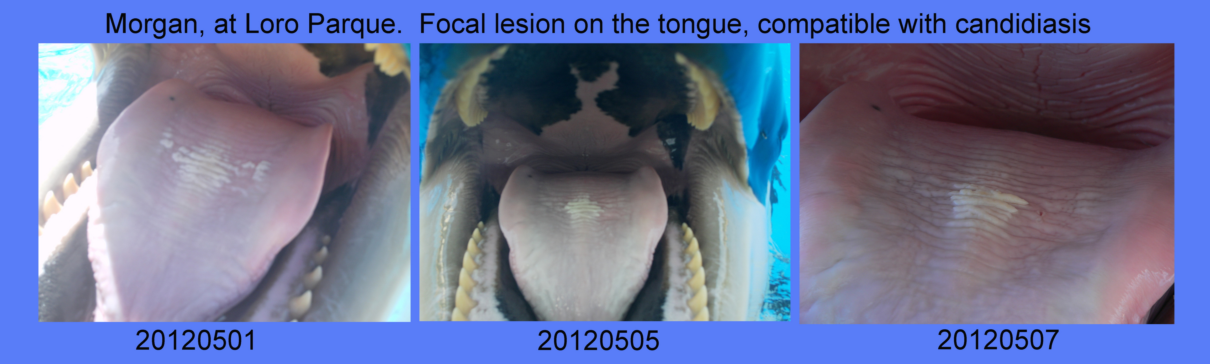 Candidiasis on the tongue of Morgan, while at Loro Parque, 1, 5 & 7 May 2012